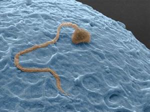 MENDEL'S LAWS OF INHERITANCE :